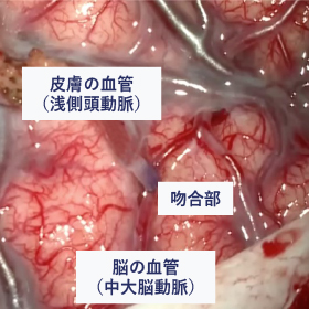 術中蛍光撮影